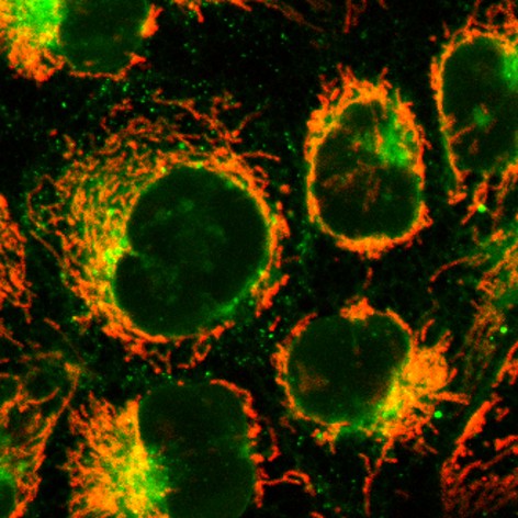 A new paper on triazinium ligation in Angewandte Chemie